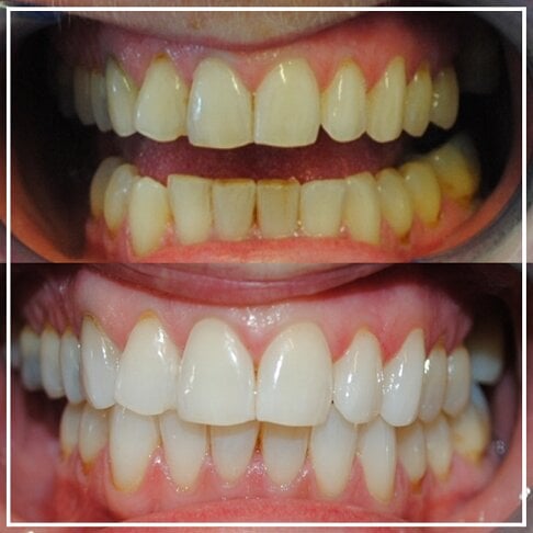 Original Marvis whitening mint toothpaste / معجون أسنان مارفيس للتبييض بنكهة النعناع