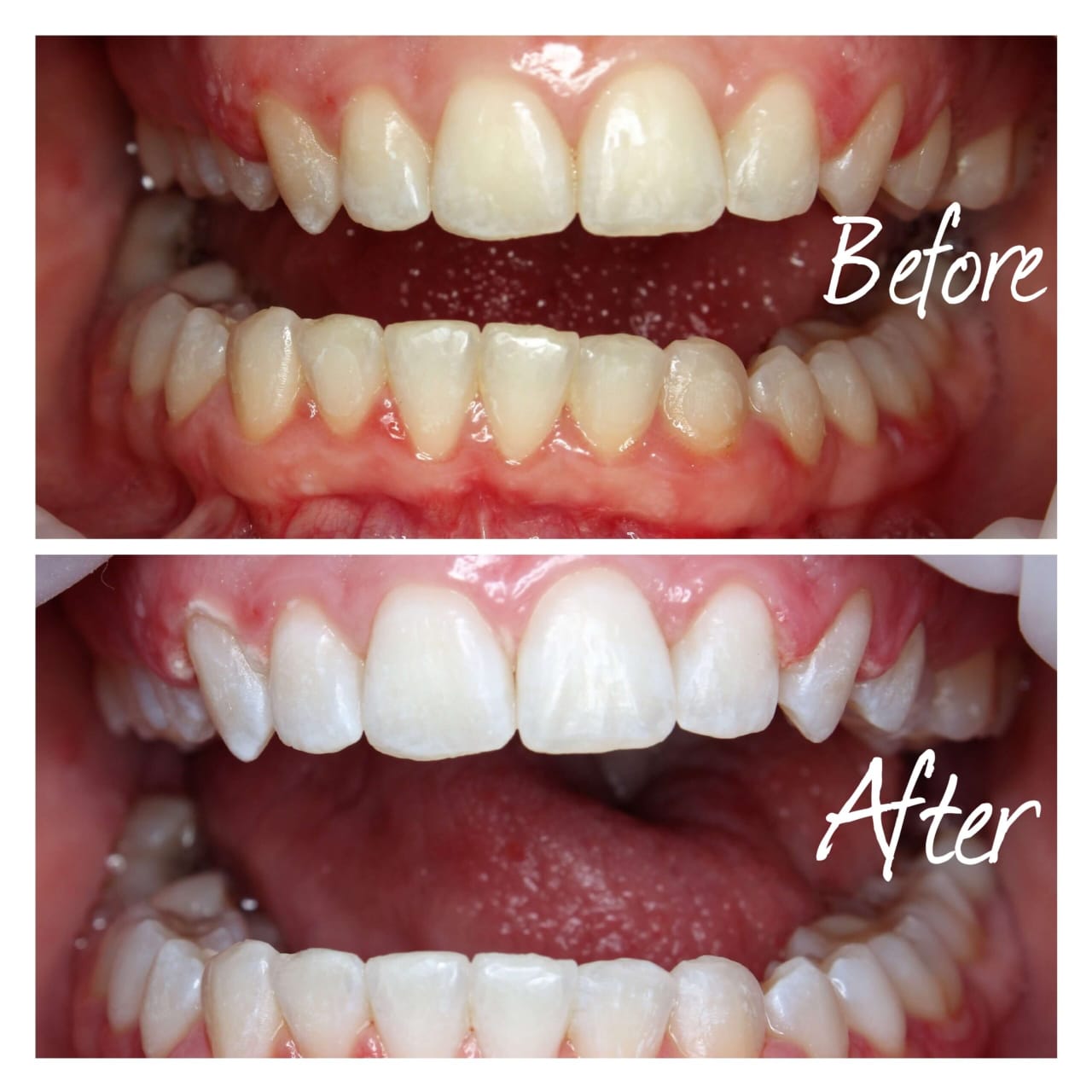 Original Marvis whitening mint toothpaste / معجون أسنان مارفيس للتبييض بنكهة النعناع